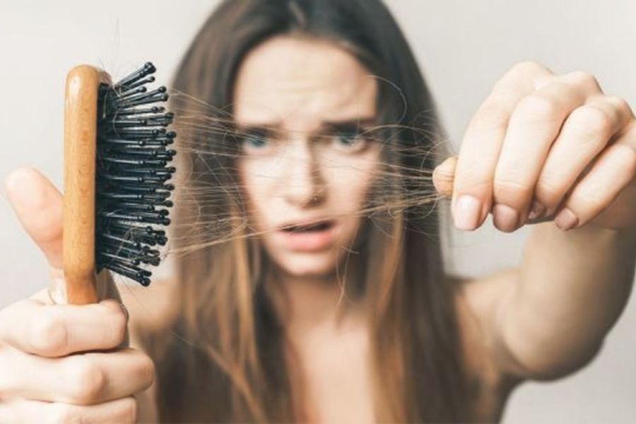 Unlocking the Power of Homeopathy: Naturally Treat PCOS-Induced Hair Loss without Side Effects