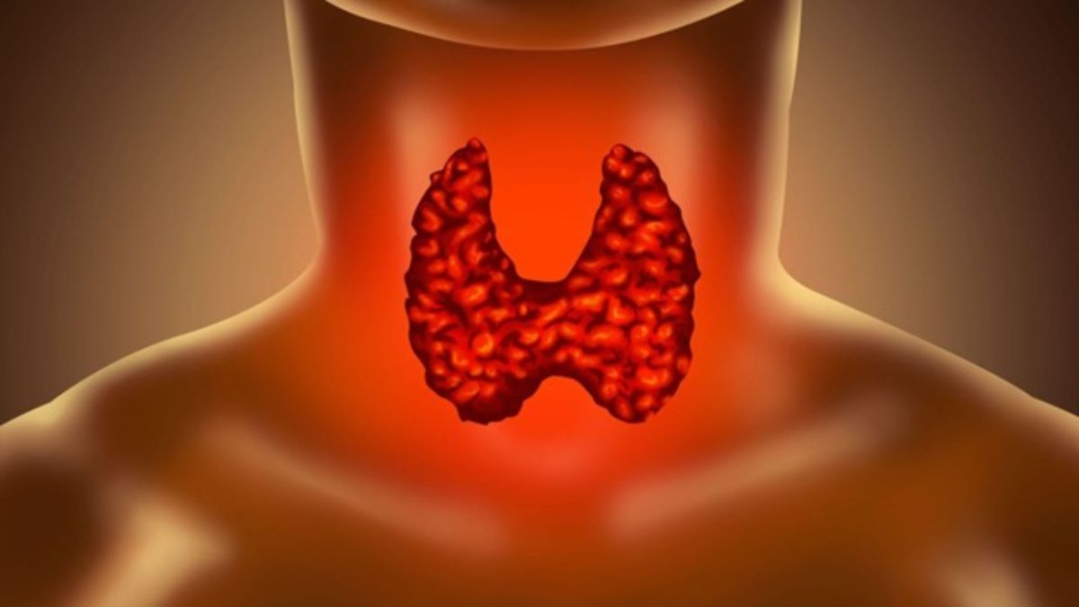 Throat Cancer symptoms other than common cold